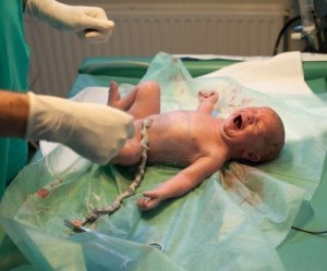 Il piccolo viene visitato subito dal neonatologo solo se ci solo imprevisti